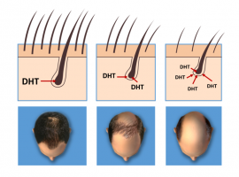 Click image for larger version

Name:	Headstand-hair-growth-e1586786332788.png
Views:	202
Size:	48.3 KB
ID:	73204